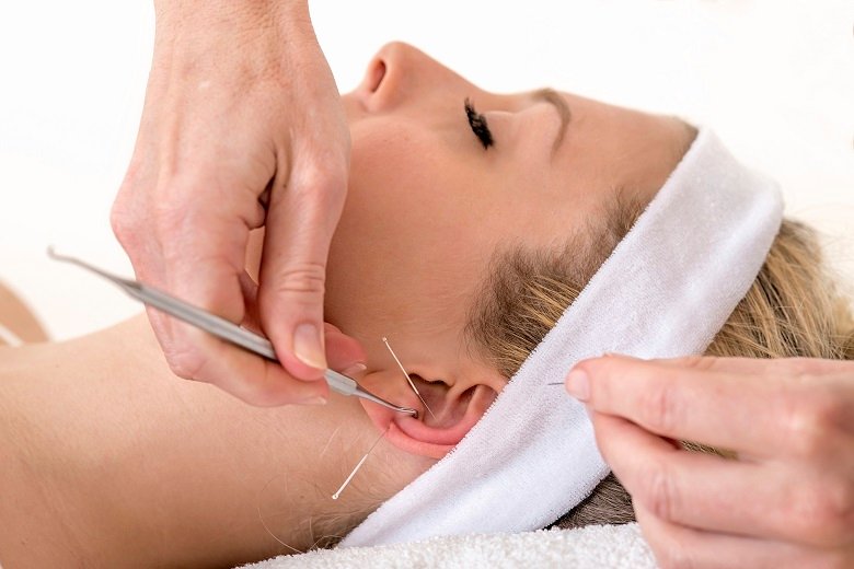Good word-of-mouth for auriculotherapy